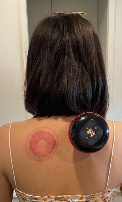 Smart Cupping Massager